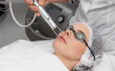 3 Reasons Why Your Skin Should Be Treated With Pico Laser