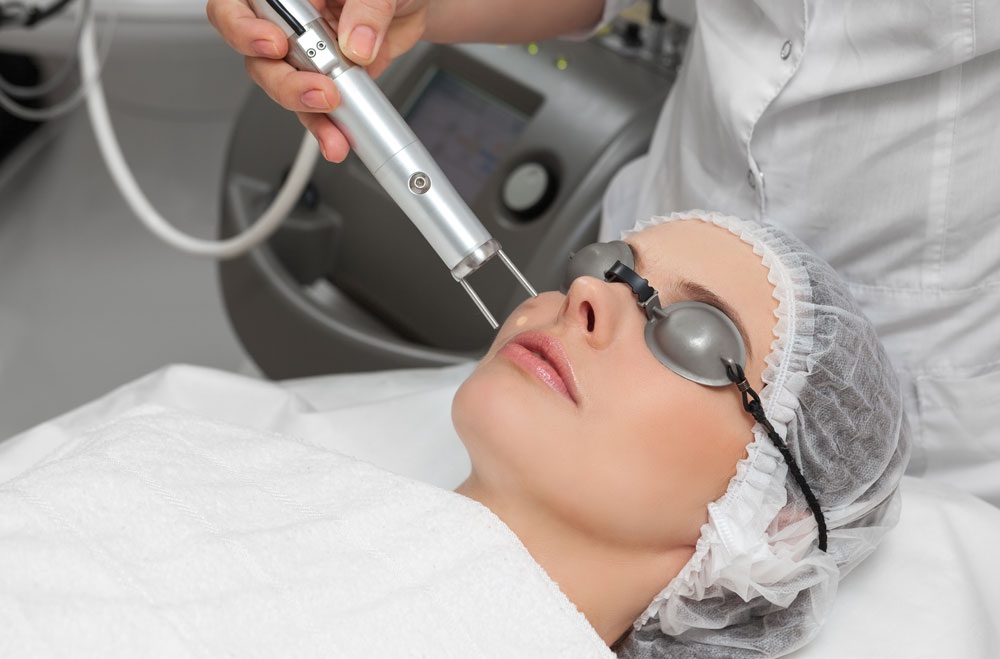 3 Reasons Why Your Skin Should Be Treated With Pico Laser
