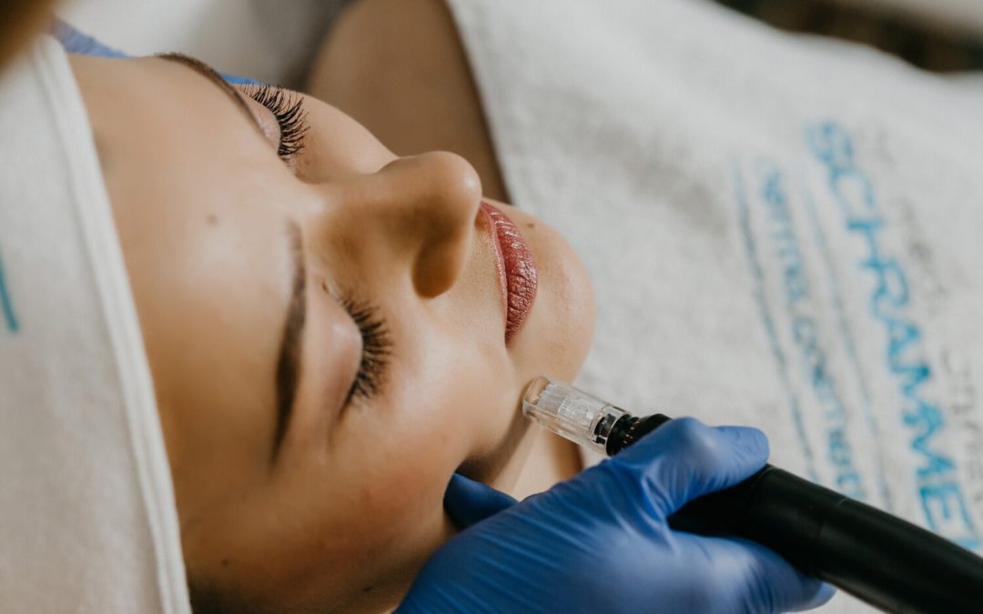 Best Laser Treatment for Skin at DSC Laser & Skin Care: A Guide for Cosmetic Procedures