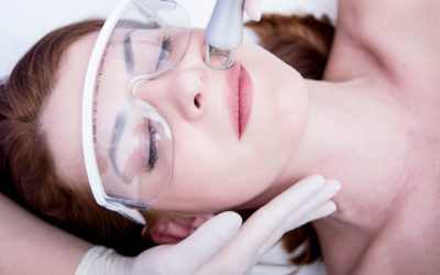 How Does Micro-needling Compare to Laser Resurfacing
