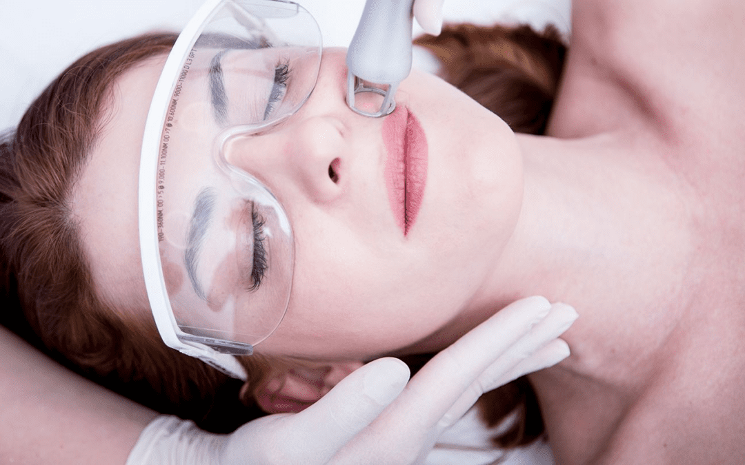 How to Find the Right Skin Laser Clinic