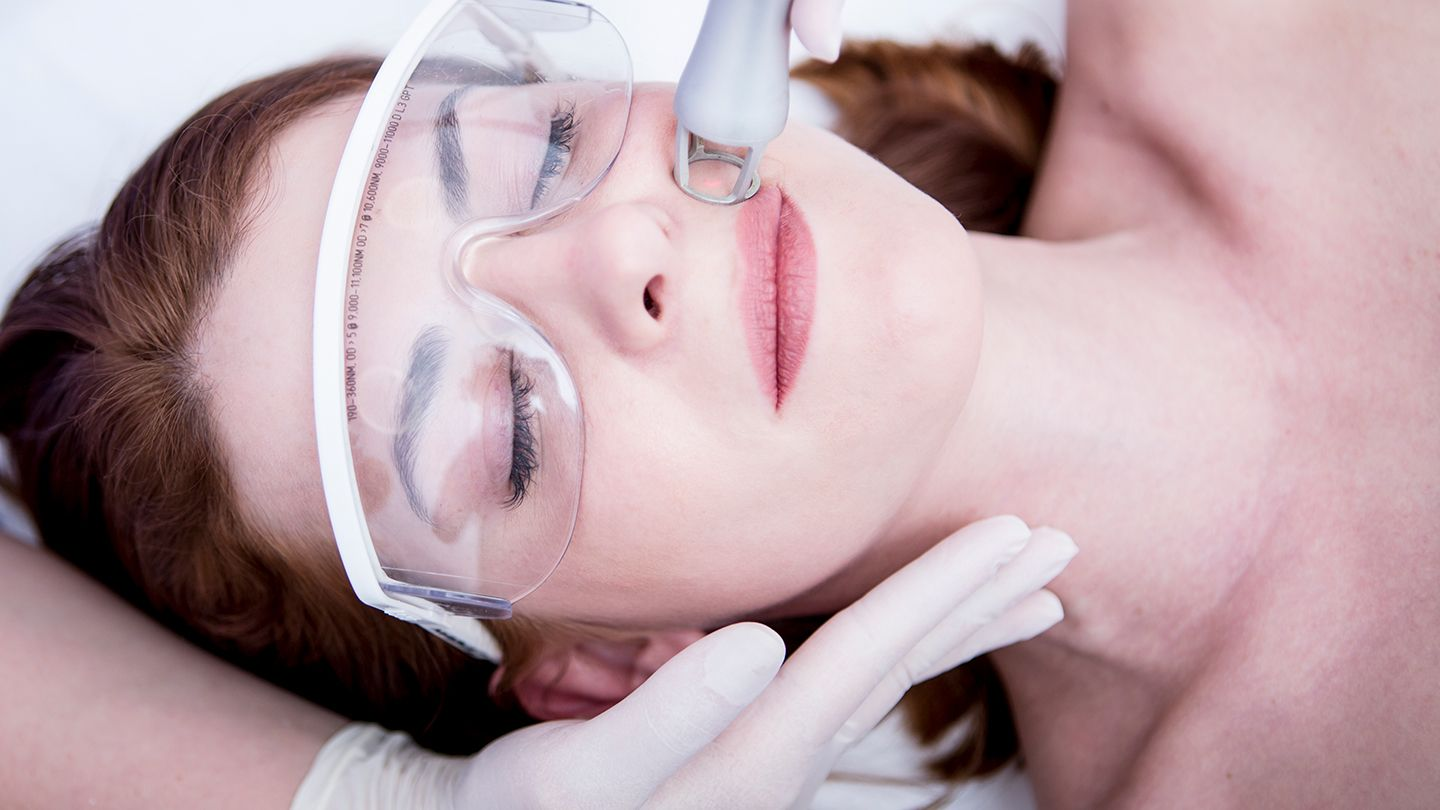 how-skin-laser-treatment-can-make-you-look-younger