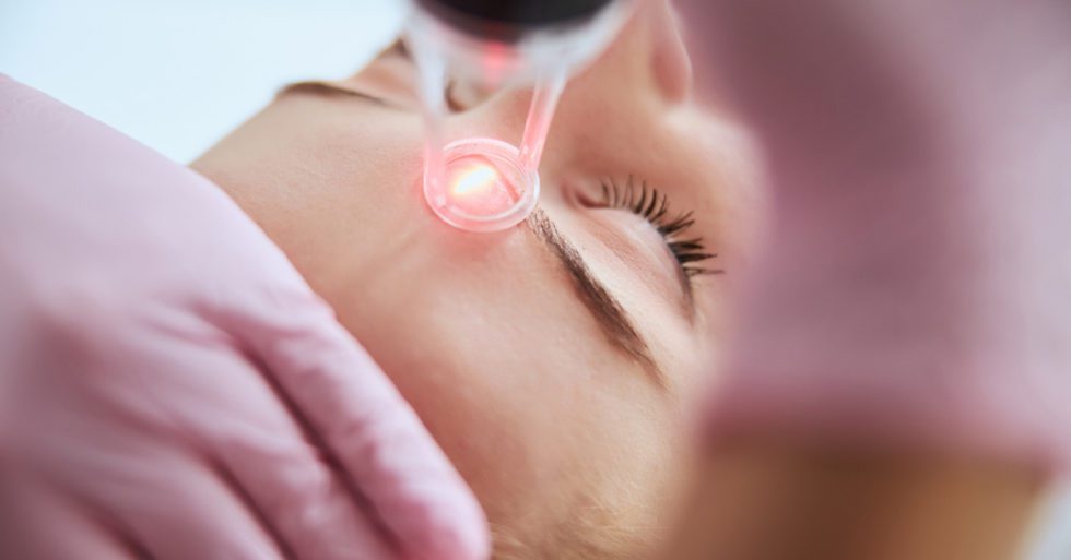 What Does Laser Treatment Do To Your Face