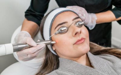 Is A Microdermabrasion Treatment Good For Your Skin?