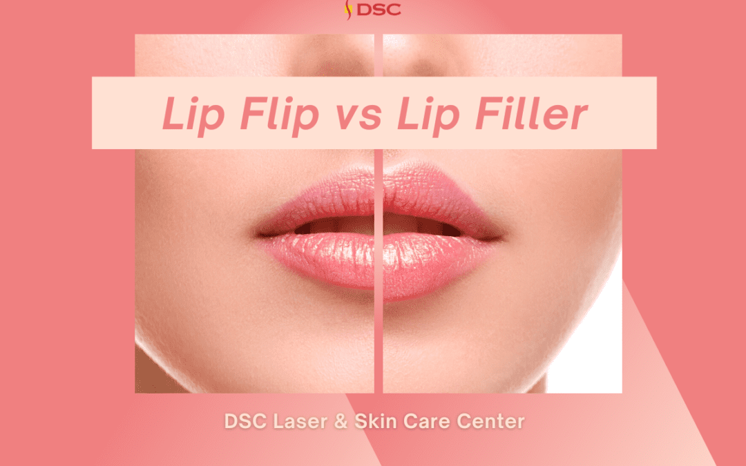 "Lip Flip vs Lip Filler" text at the top of DSC blog pink graphic with before lip filler on the left image and after lip filler image on the right