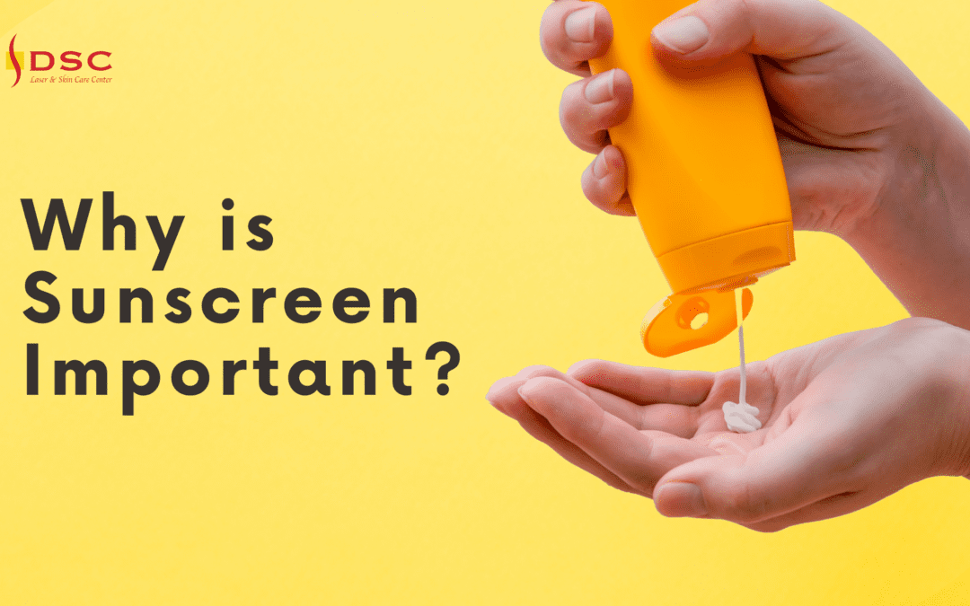 "Why is sunscreen important?" text on blog banner with yellow background and hands squeezing sunscreen into palm and DSC logo above text