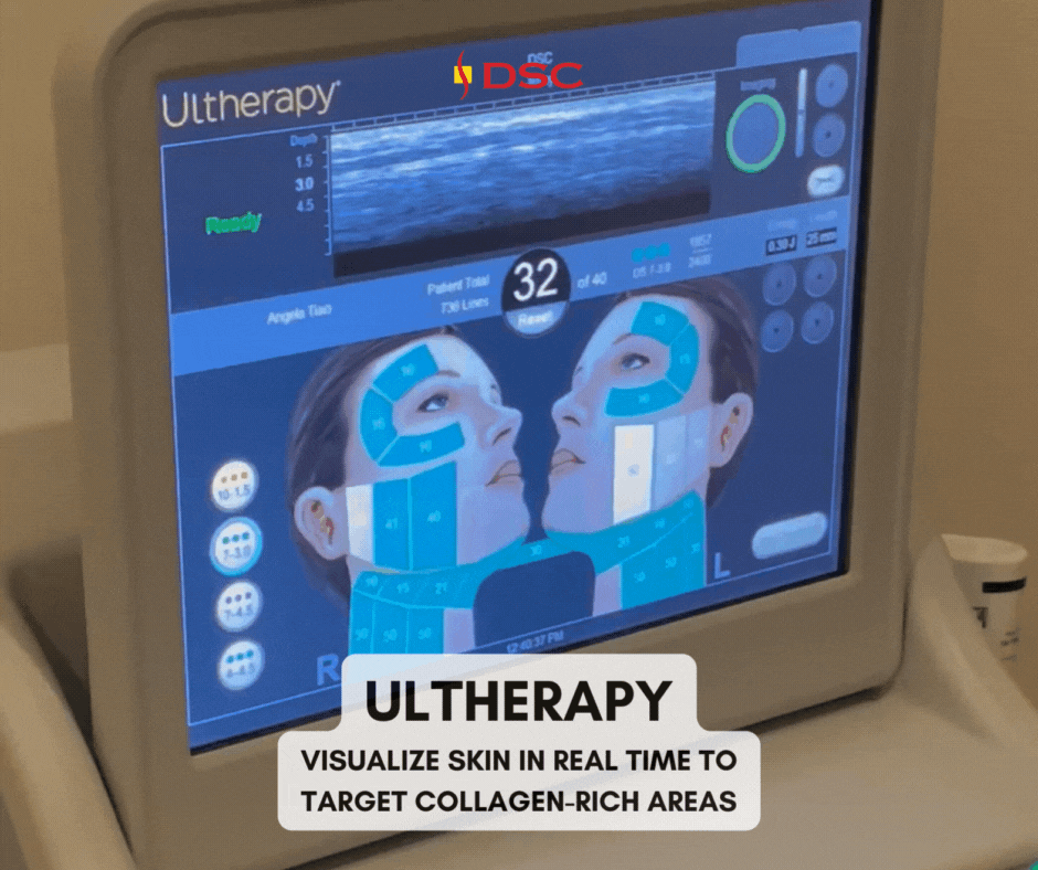 DSC Ultherapy device treatment screen visualizing collagen-rich areas of skin during treatment gif with caption "Ultherapy visualize skin in real time to target collagen-rich areas" overlaid at the bottom 