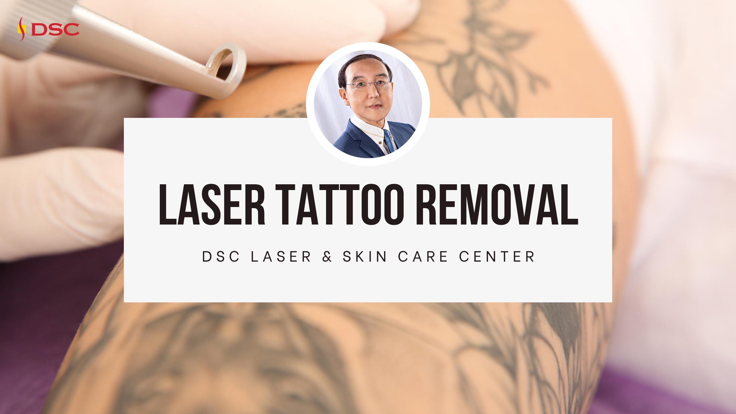 DSC Laser Tattoo Removal Blog Banner with Dr Tony K Shum headshot and the text "Laser Tattoo Removal" on white text background above "DSC Laser & Skin Care Center" with background image of arm with tattoo and laser handpiece