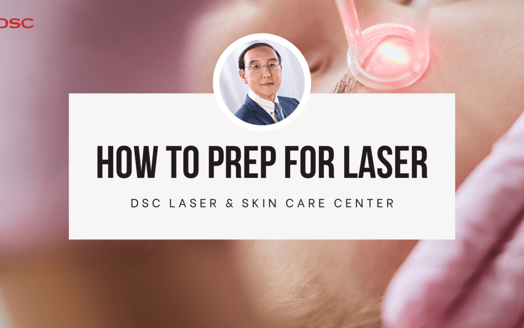 DSC How to Prepare for Laser Blog Banner with background image of laser aimed on person's face and Dr. Tony Shum headshot in the center with a white text box with the text "how to prep for laser" over "DSC Laser & Skin Care Center"