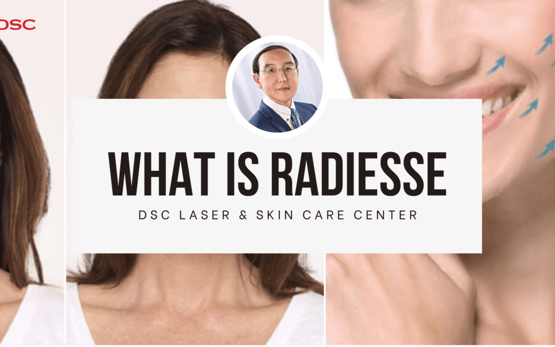 DSC what is radiesse blog banner with woman's face as background image in triplicate and dr tony shum head shot centered over white box with text "What is Radiesse" over " DSC Laser & Skin Care Center"