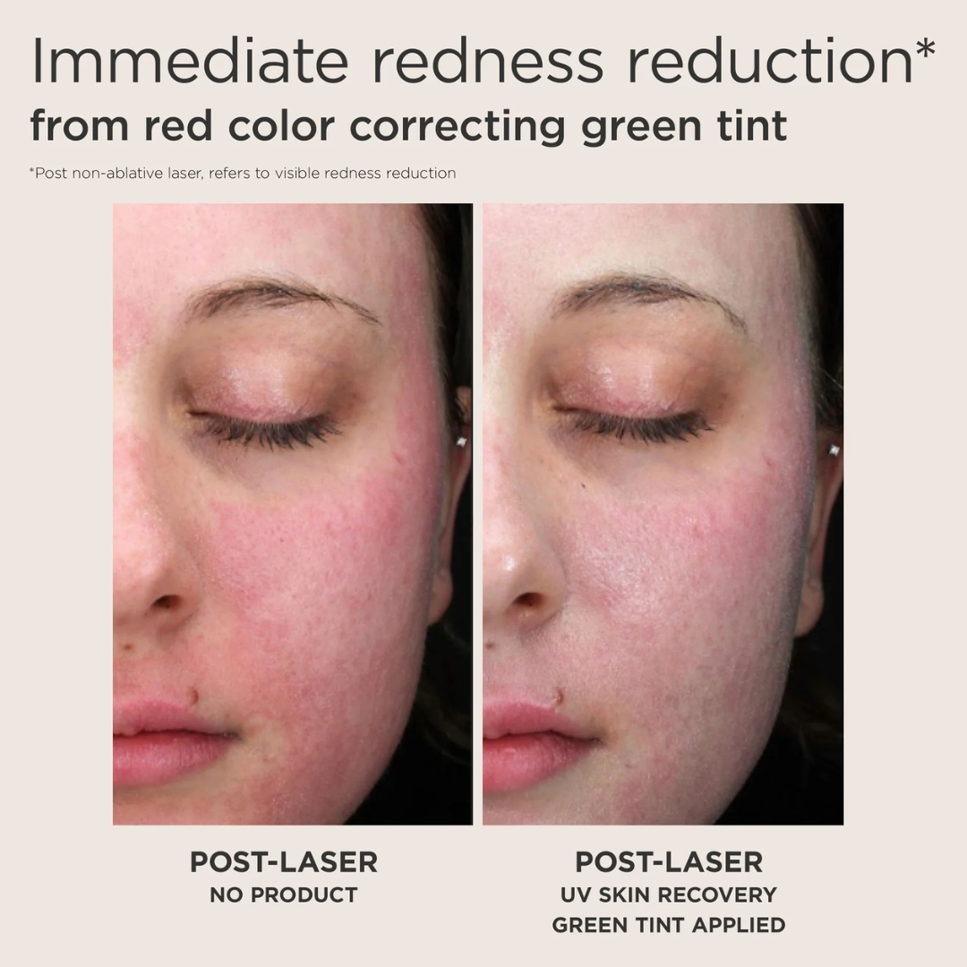 Image collage of before and after applying EltaMD UV Recovery Red Color Correcting Green TInt SPF 50 on woman's face after laser from left to right - left image of right face of red female face, right image of same half face with spf applied and redness is more neutralized