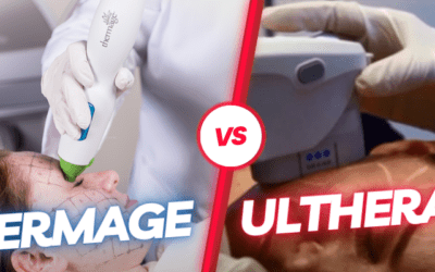Ultherapy vs. Thermage
