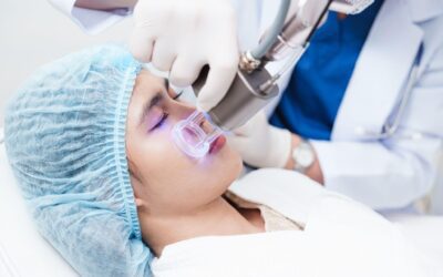 Laser Skin Resurfacing in San Gabriel – Get Radiant Skin
