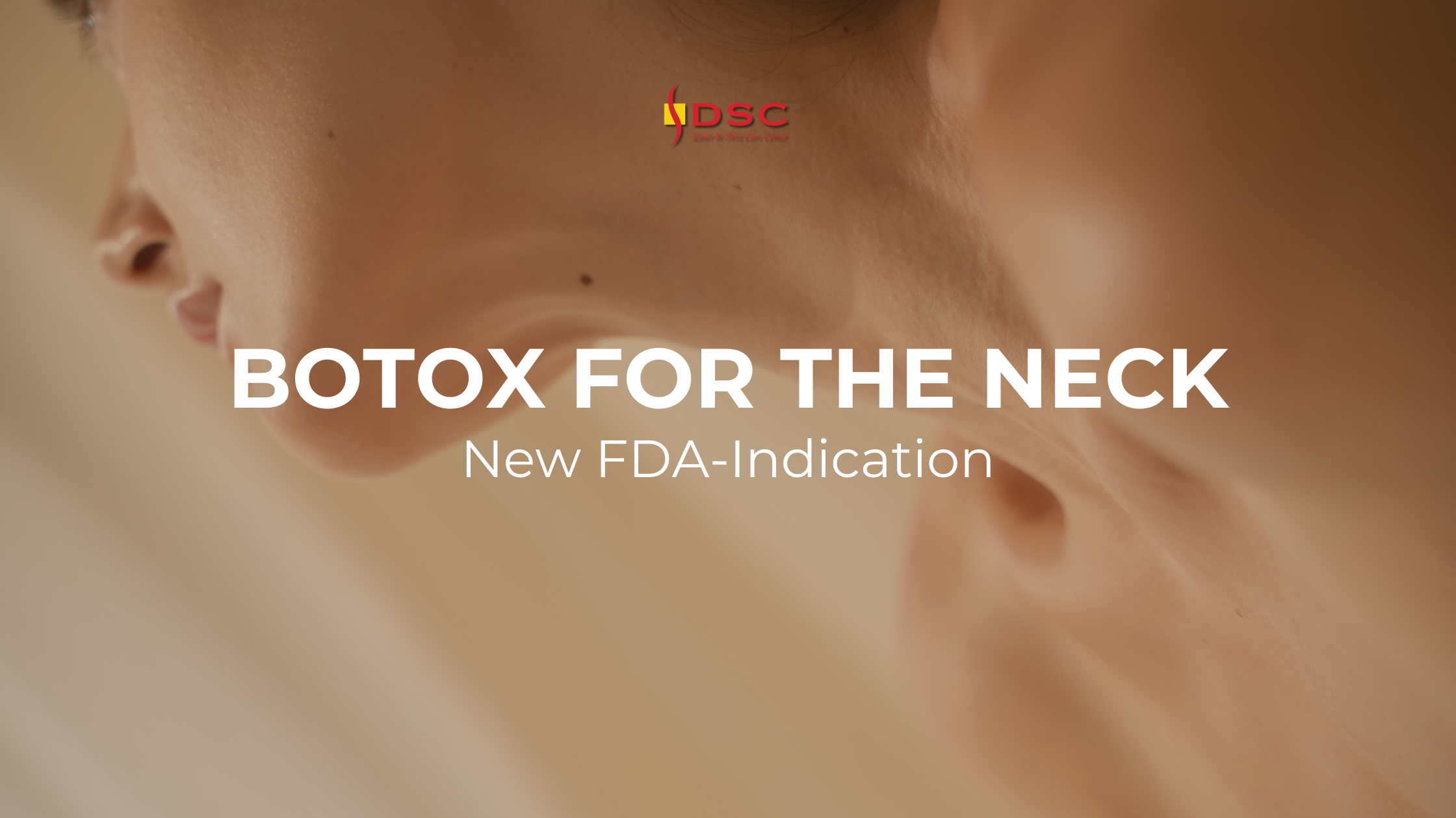 botox for the neck blog banner