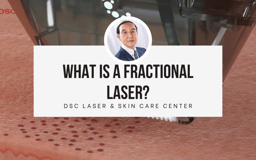 what is a fractional laser blog banner