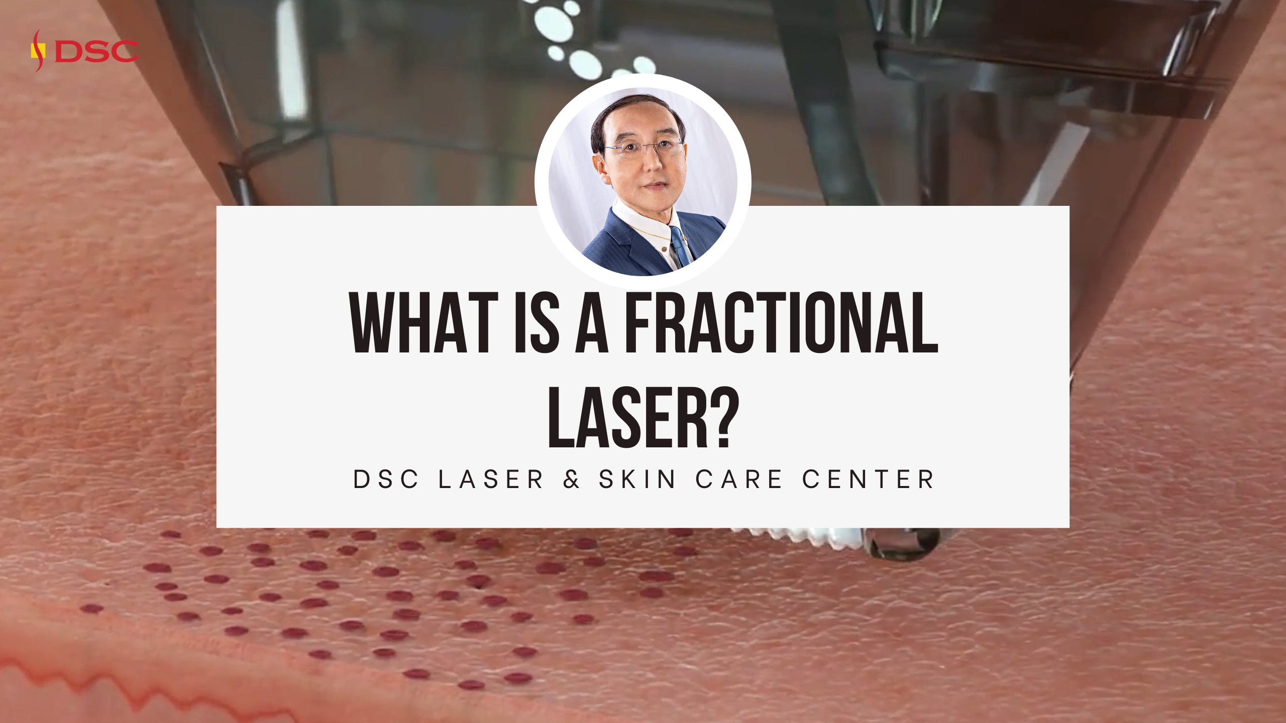 what is a fractional laser blog banner
