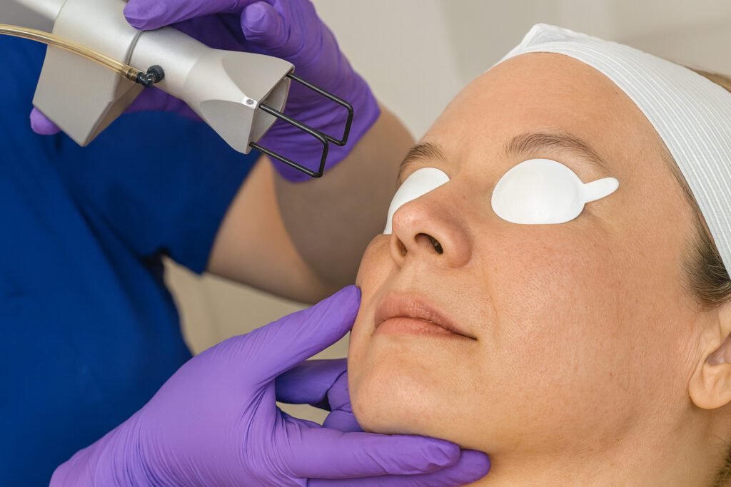 Laser-Based Tightening and Skin Quality Rejuvenation
