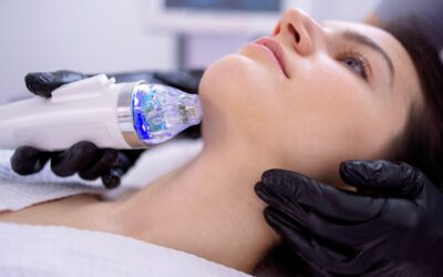 RF Microneedling Benefits: Transform Your Skin in San Gabriel & LA With Confidence