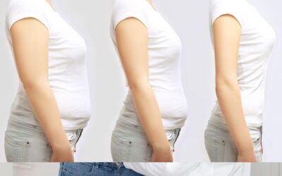 Medical Weight Loss San Gabriel, CA: How to Slim Down Safely