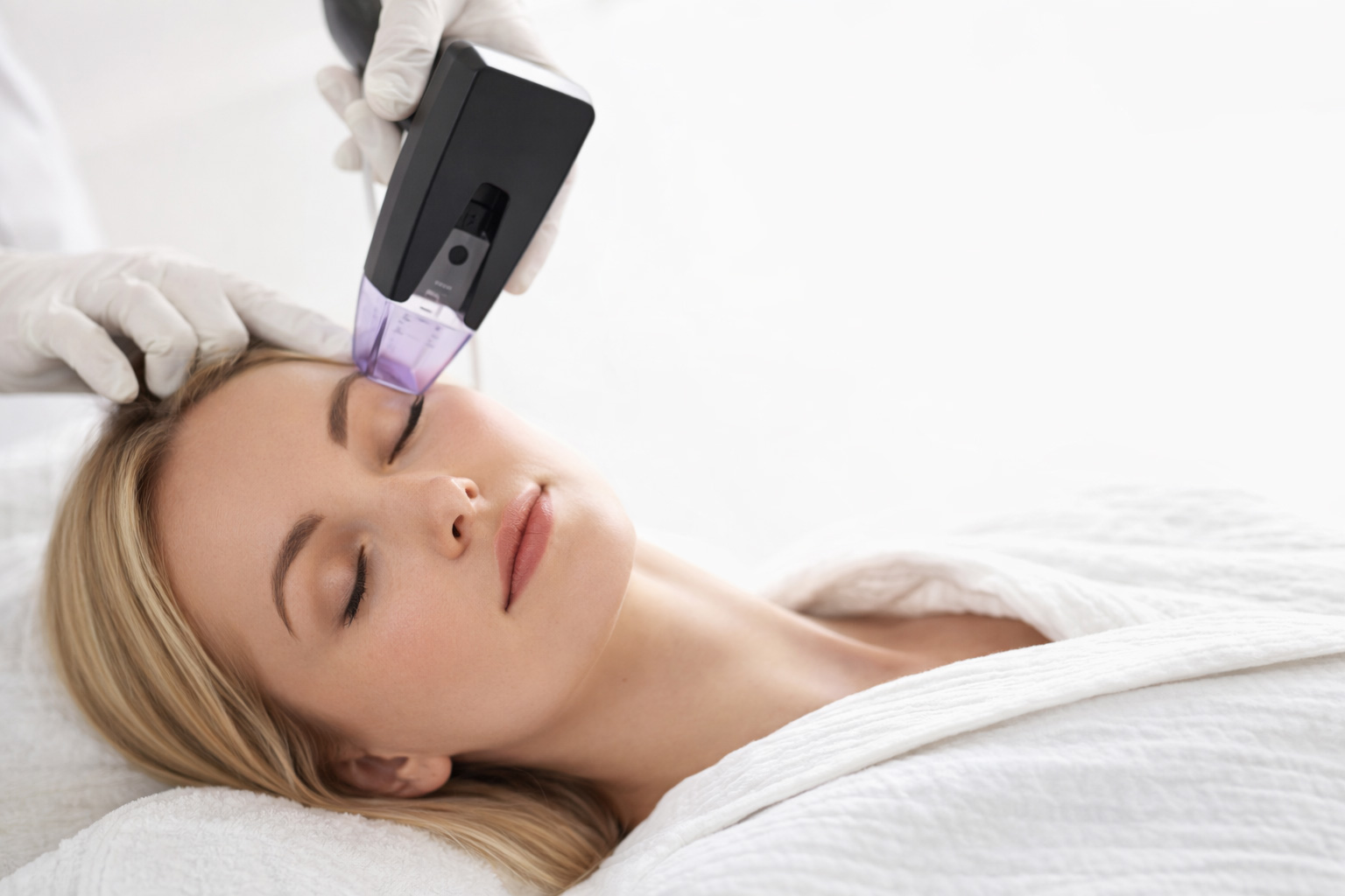 Morpheus8 Results: What to Expect and When