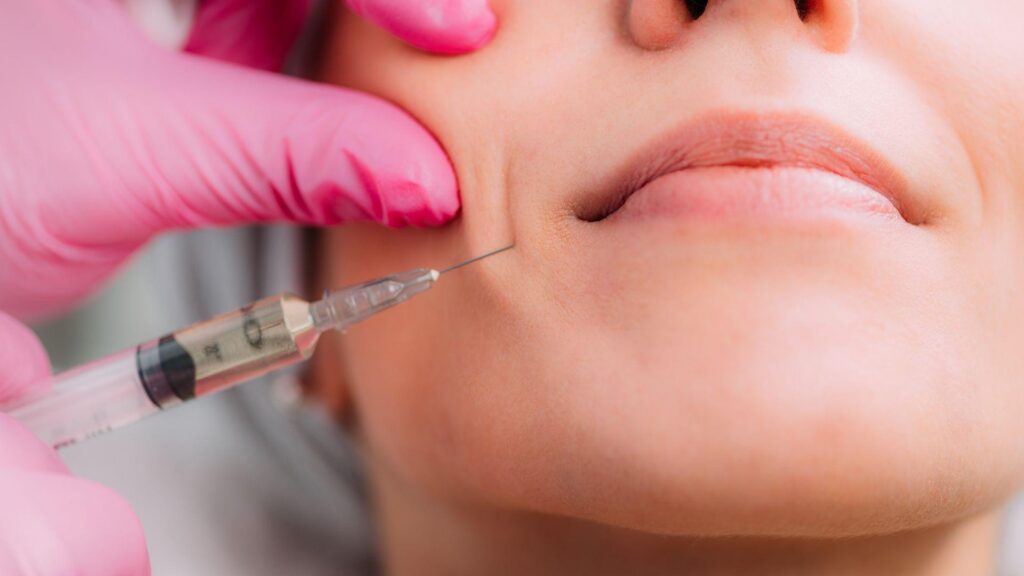 Common Dermal Filler Options Used in LA