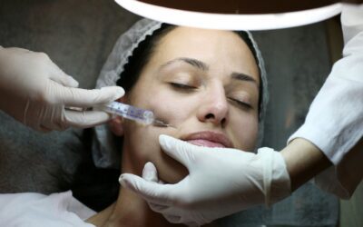 Sculptra Before and After: What to Expect in San Gabriel and Los Angeles