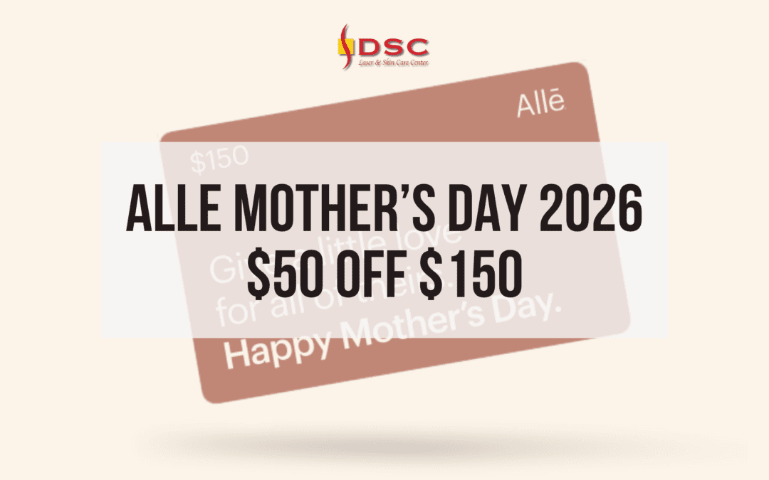 Alle Mother’s Day 2026 – $50 off $150