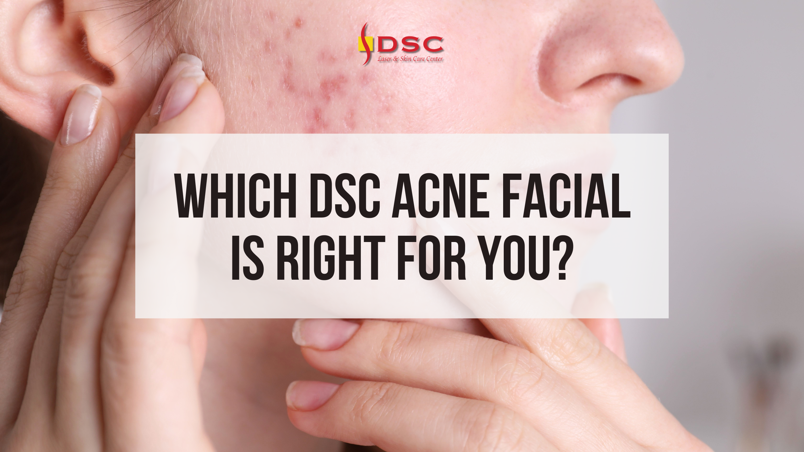 Which DSC Acne Facial Is Right For You blog banner Which DSC Acne Facial Is Right For You blog banner with image of woman touching cheek with breakouts