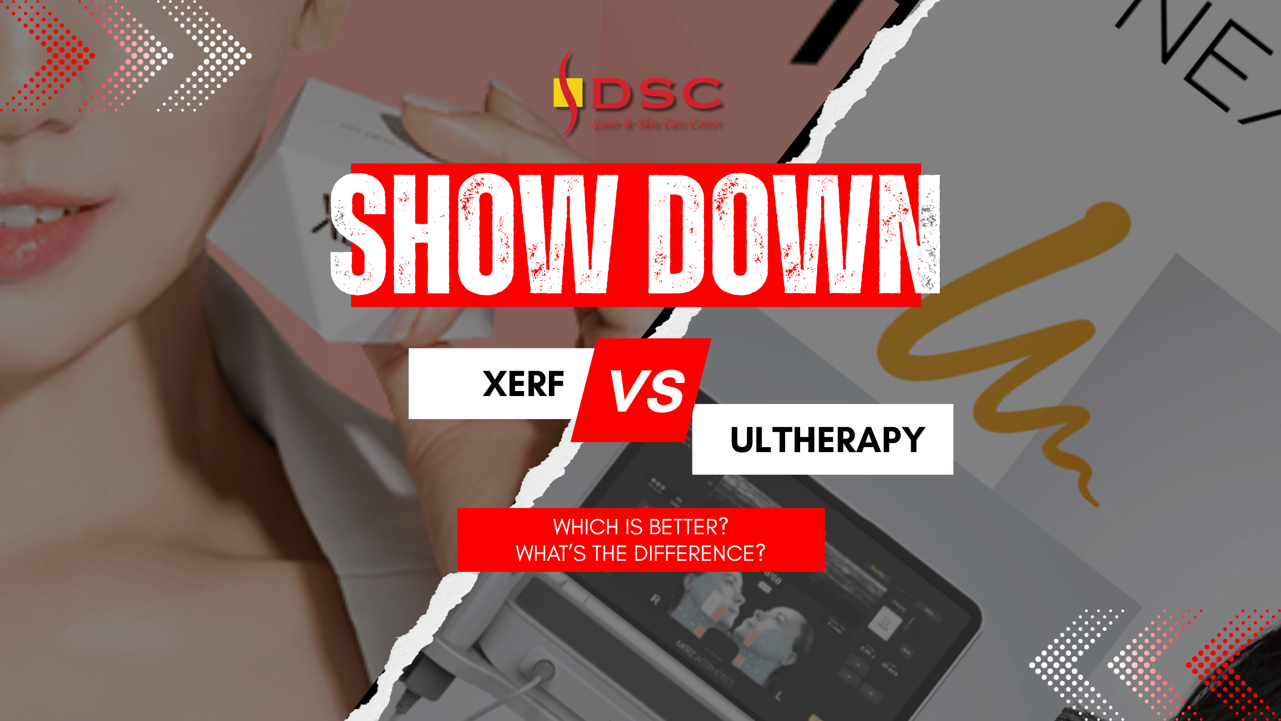 Xerf vs ultherapy blog banner Xerf vs ultherapy blog banner