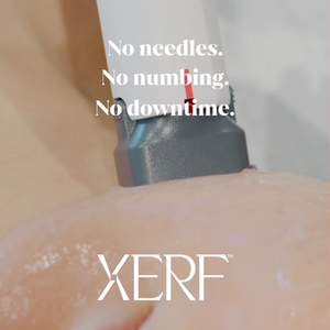 XERF comfortable skin tightening with no needles, no numbing, and no downtime