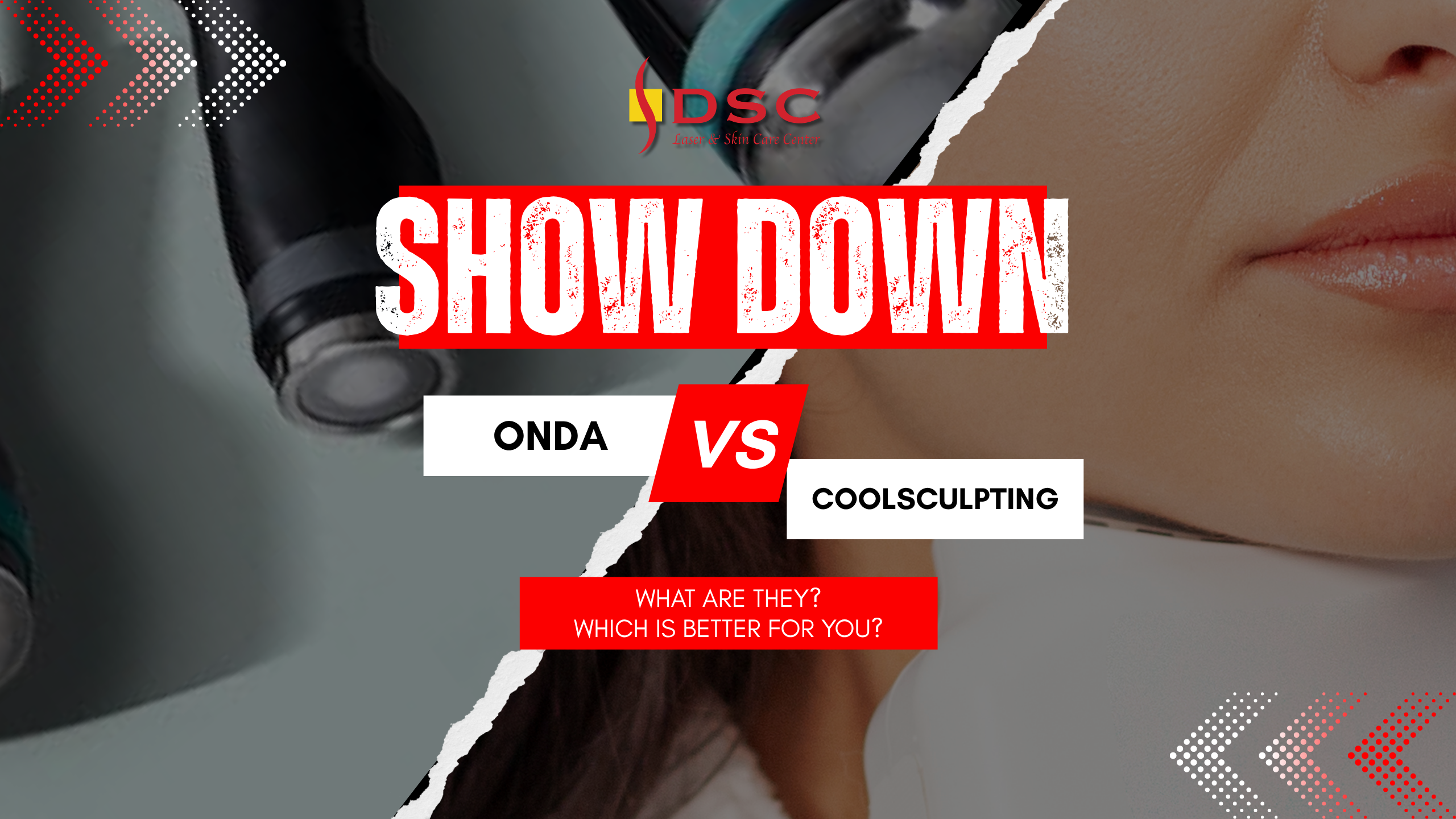 onda vs coolsculpting blog banner